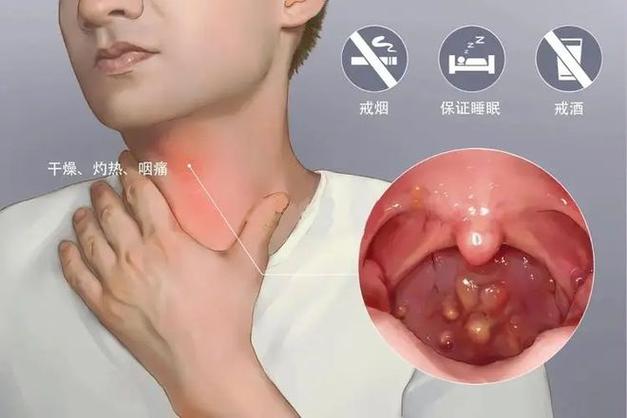 百脉根-可补虚清热、治疗咽炎湿疹